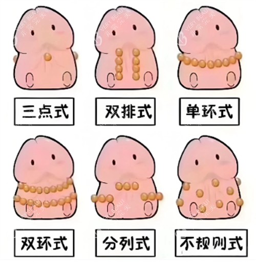 入珠的不同方式