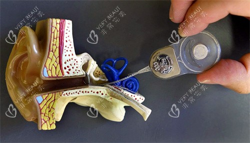 人工耳蜗和耳朵模型