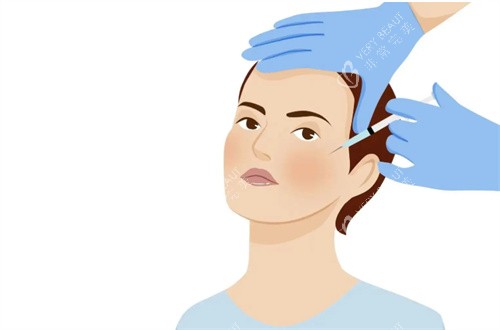 面部注射 面部注射