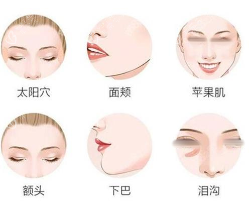 面部填充部位一览图