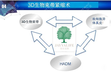 3d生物束带紧缩术讲解示意图 3d生物束带紧缩术讲解示意图
