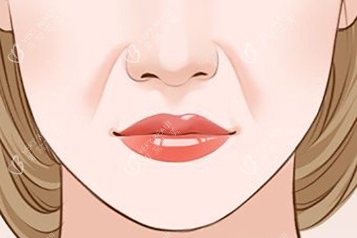 面部法令纹卡通示意图