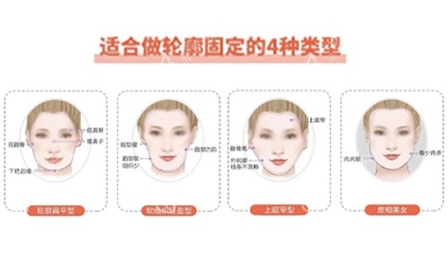 面部轮廓固定适合类型 面部轮廓固定适合类型