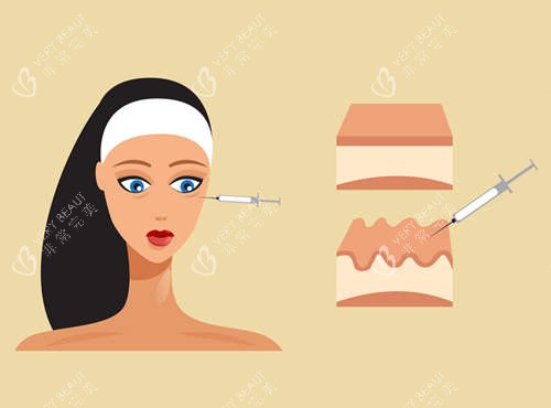 注射美容图示