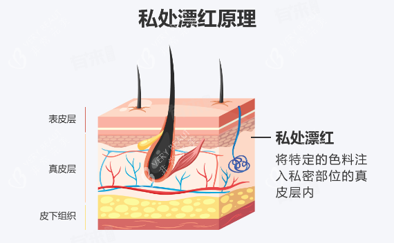 阴唇漂红原理 阴唇漂红原理