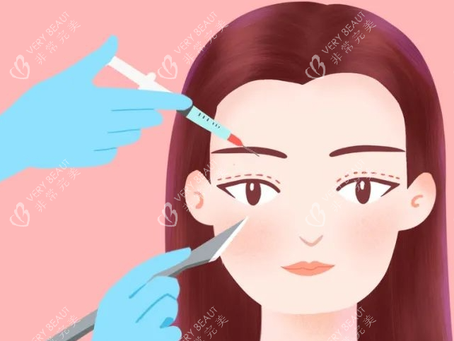 双眼皮画线展示图 双眼皮画线展示图