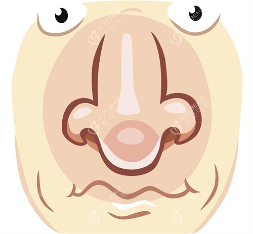 过长的鼻子需要矫正