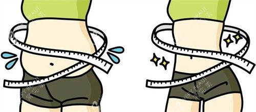 小蛮腰吸脂前后