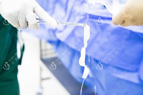 3d生物束带紧缩术实物图 3d生物束带紧缩术实物图