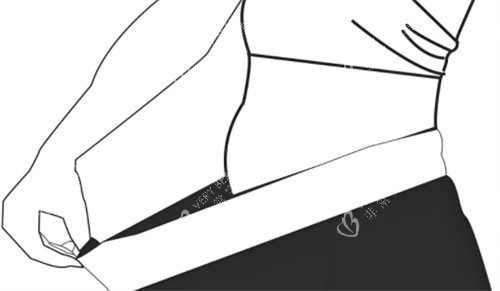 激光溶脂瘦腰前后个人对比 激光溶脂瘦腰前后个人对比