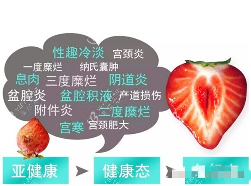 菲蜜丽解问题图示 菲蜜丽解问题图示