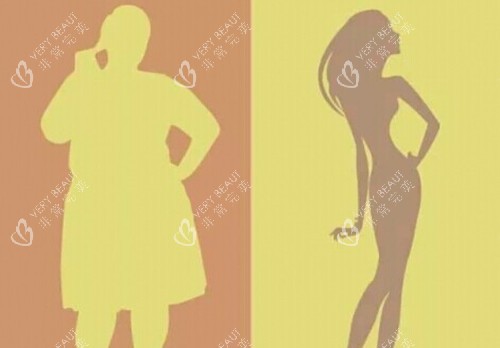 全身吸脂前后对比卡通示意图 全身吸脂前后对比卡通示意图