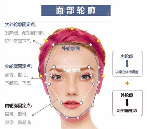 轮廓固定 轮廓固定