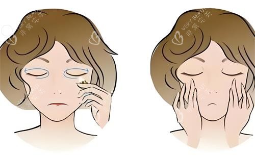 去眼袋前后对比动画图 去眼袋前后对比动画图