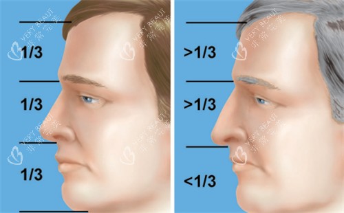 过长的鼻子和正常鼻子矫正对比 过长的鼻子和正常鼻子矫正对比