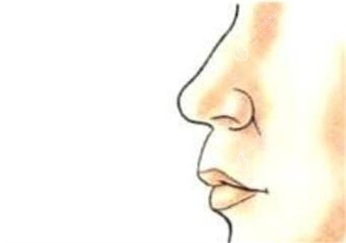 人中长凸嘴展示 人中长凸嘴展示