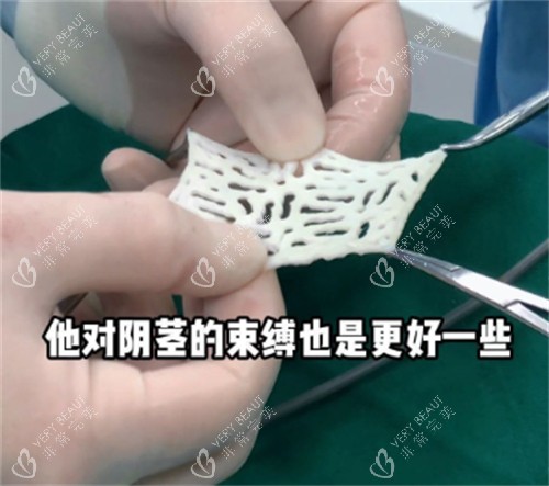 阴茎生物补片材料样子