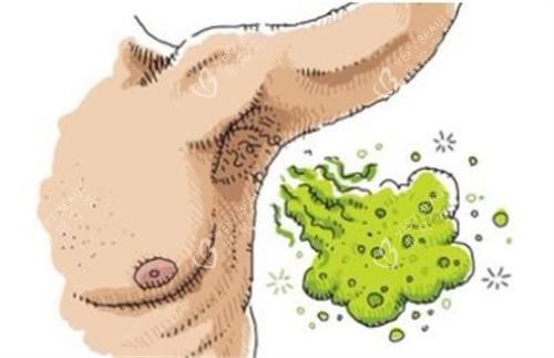 腋臭卡通图照片图