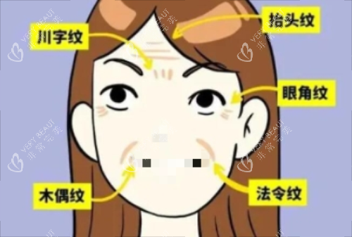 面部皱纹详细示意图 面部皱纹详细示意图