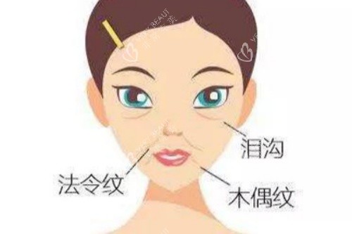 脸上皱纹卡通图片