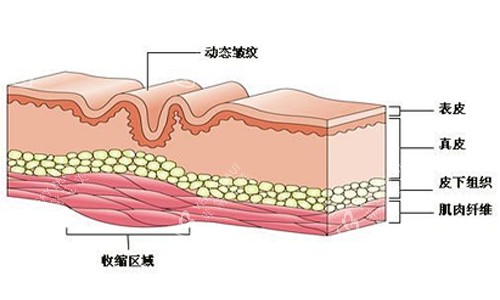 皮肤上皱纹的产生