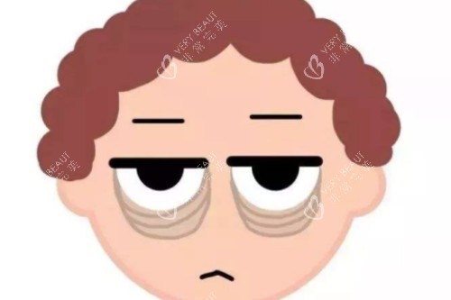 眼袋卡通图片展示 眼袋卡通图片展示