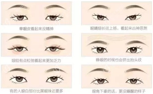 不同可以进行双眼皮的眼睛