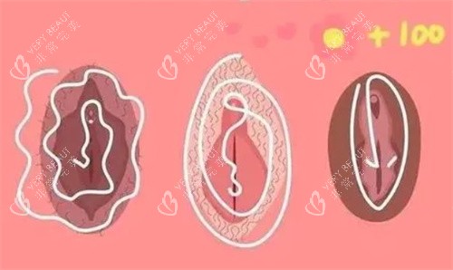 私密漂红卡通图 私密漂红卡通图