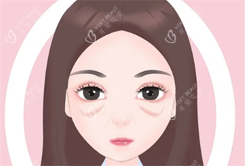 眼袋图