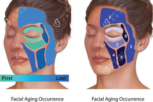 面部填充分区结果 面部填充分区结果