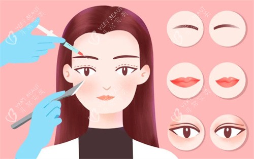 双眼皮修复卡通