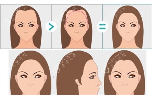 女性m型发际线卡通图