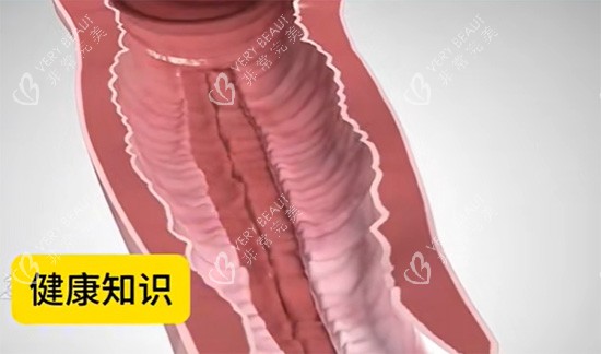 阴道紧缩针原理图片