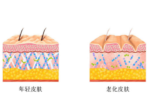 平滑皮肤和有皱纹皮肤示意图