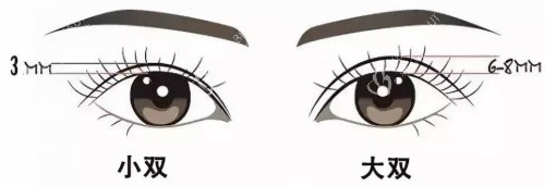 双眼皮宽度示意图