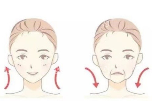 面部提升卡通对比图