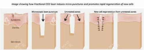 身体疤痕 身体疤痕