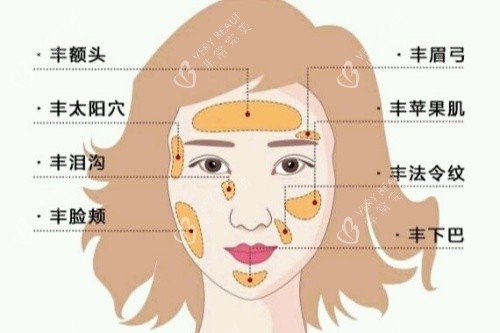 自体脂肪面部填充卡通图一览 自体脂肪面部填充卡通图一览