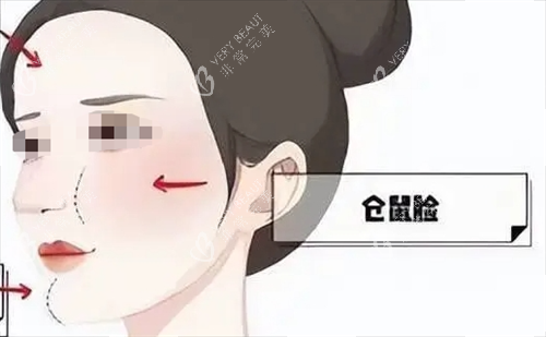 玻尿酸后馒化现象动画展示