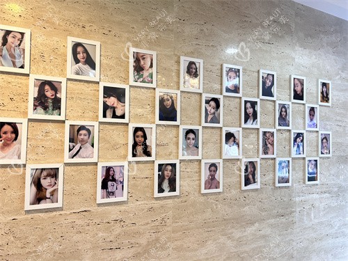 韩国珠儿丽整形外科顾客展示