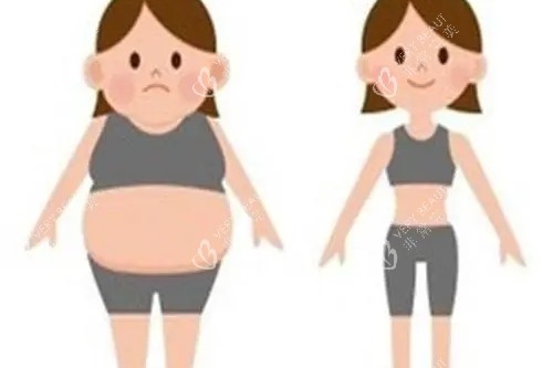 吸脂卡通对比图