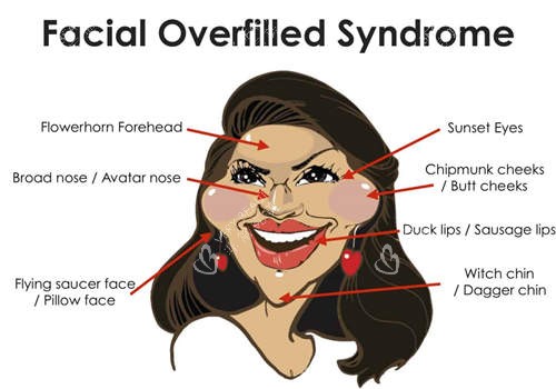 面部填充过度图 面部填充过度图