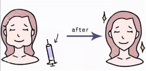 打针瘦脸卡通图 打针瘦脸卡通图