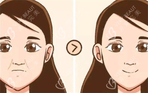 法令紋前后對(duì)比