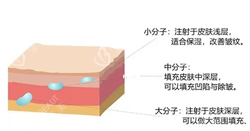 注射層次