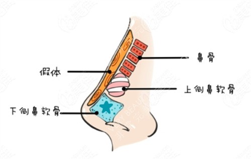 隆鼻動(dòng)畫(huà)解剖圖