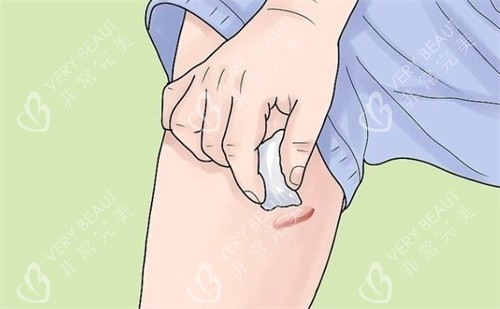 疤痕疙瘩怎么護(hù)理
