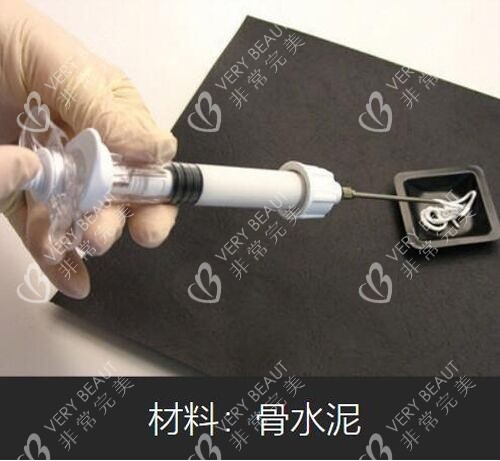骨水泥材料實(shí)物展示圖