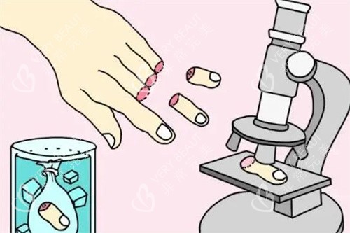 断指手术卡通图