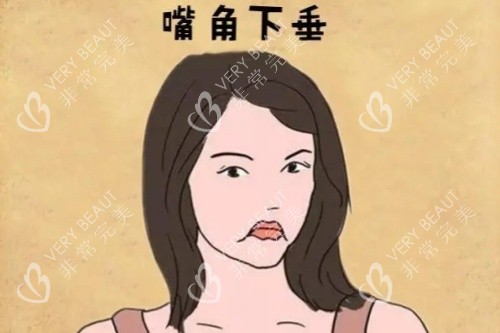 嘴角下垂卡通圖
